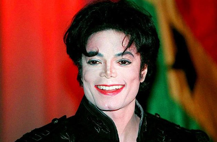 Khuon mat Michael Jackson bi pha hong the nao sau dao keo-Hinh-5